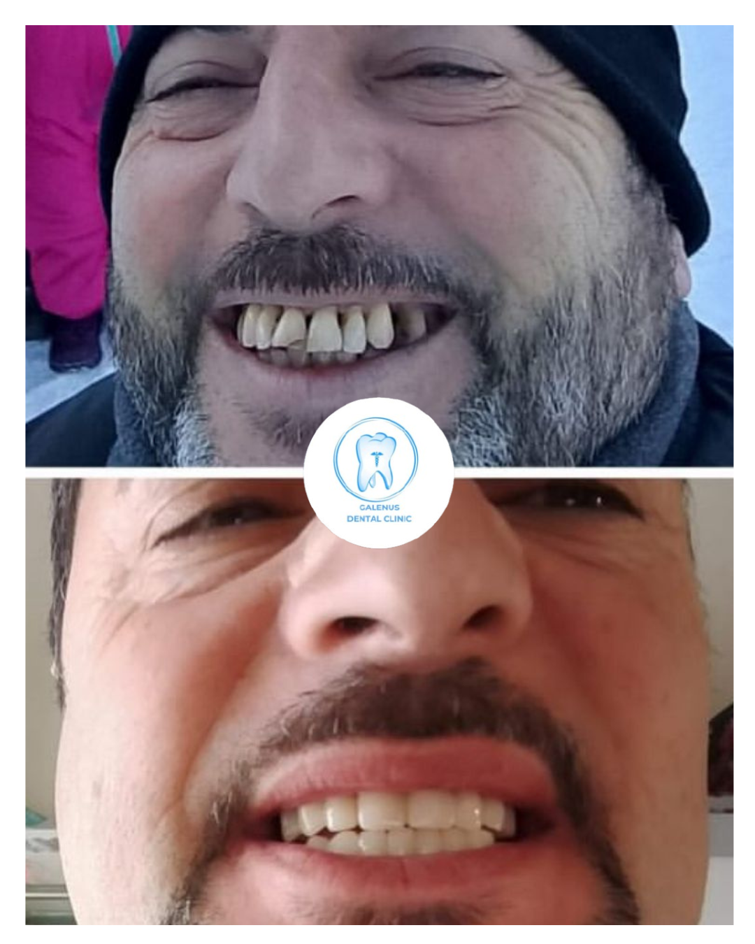 Caso clinico 3